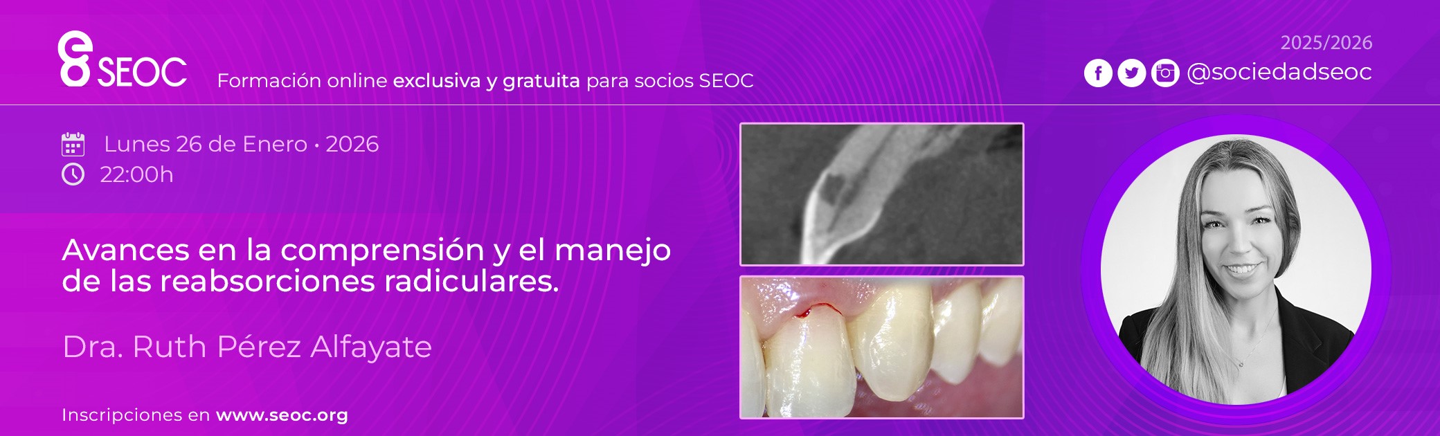 Avances en la compresi�n y el manejo de las reabsorciones radiculares