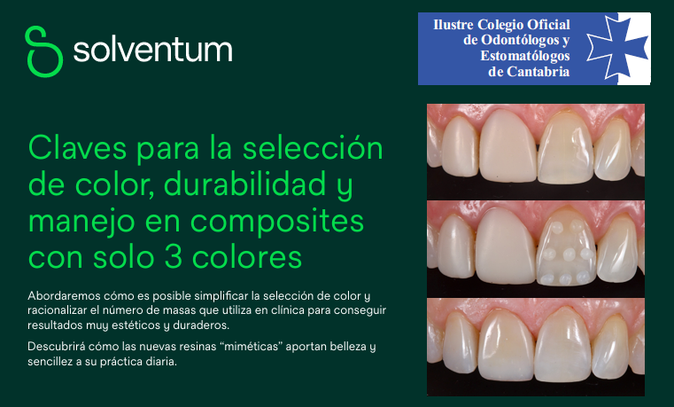 Claves para la seleccin de color, durabilidad y manejo en composites con solo 3 colores